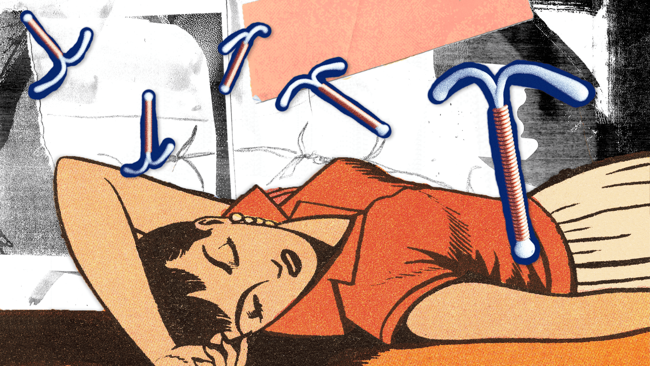 Qu’est-ce que la douleur associée à un DIU? cover image